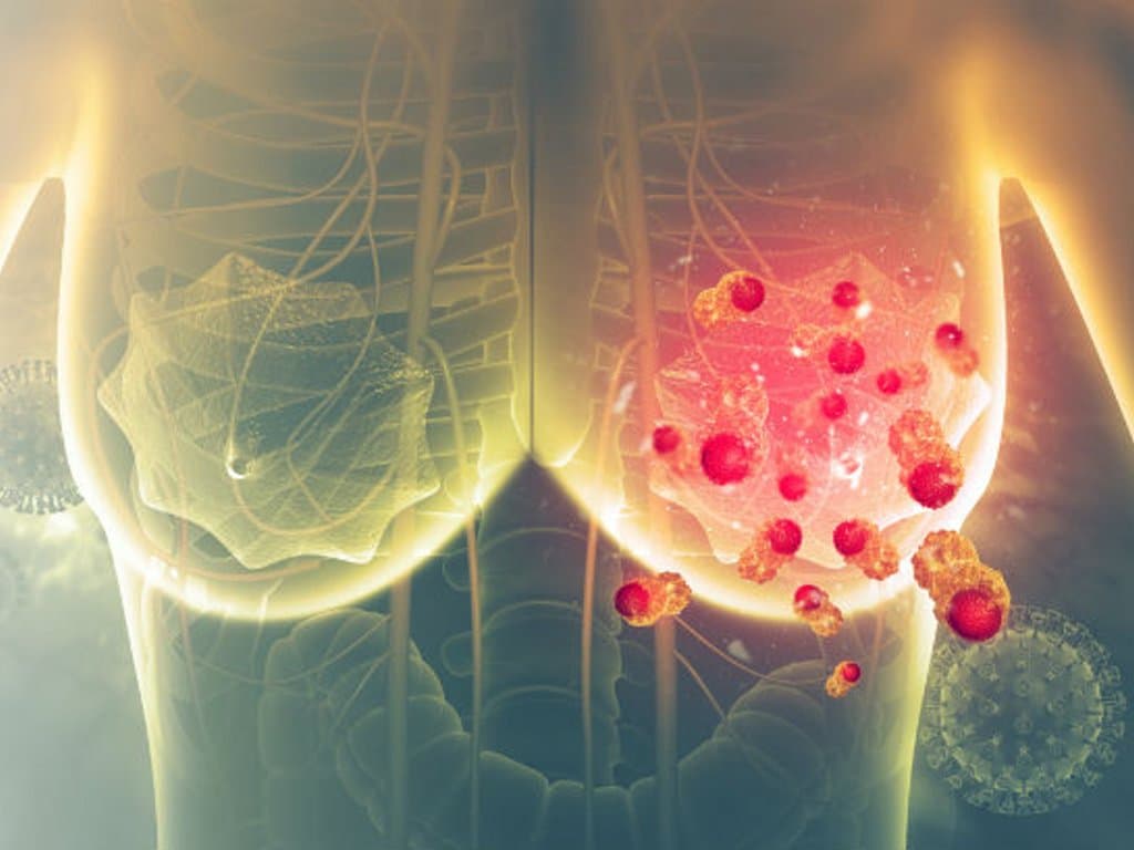 Prognostic value of STE and PEPI in HR+ breast cancer
