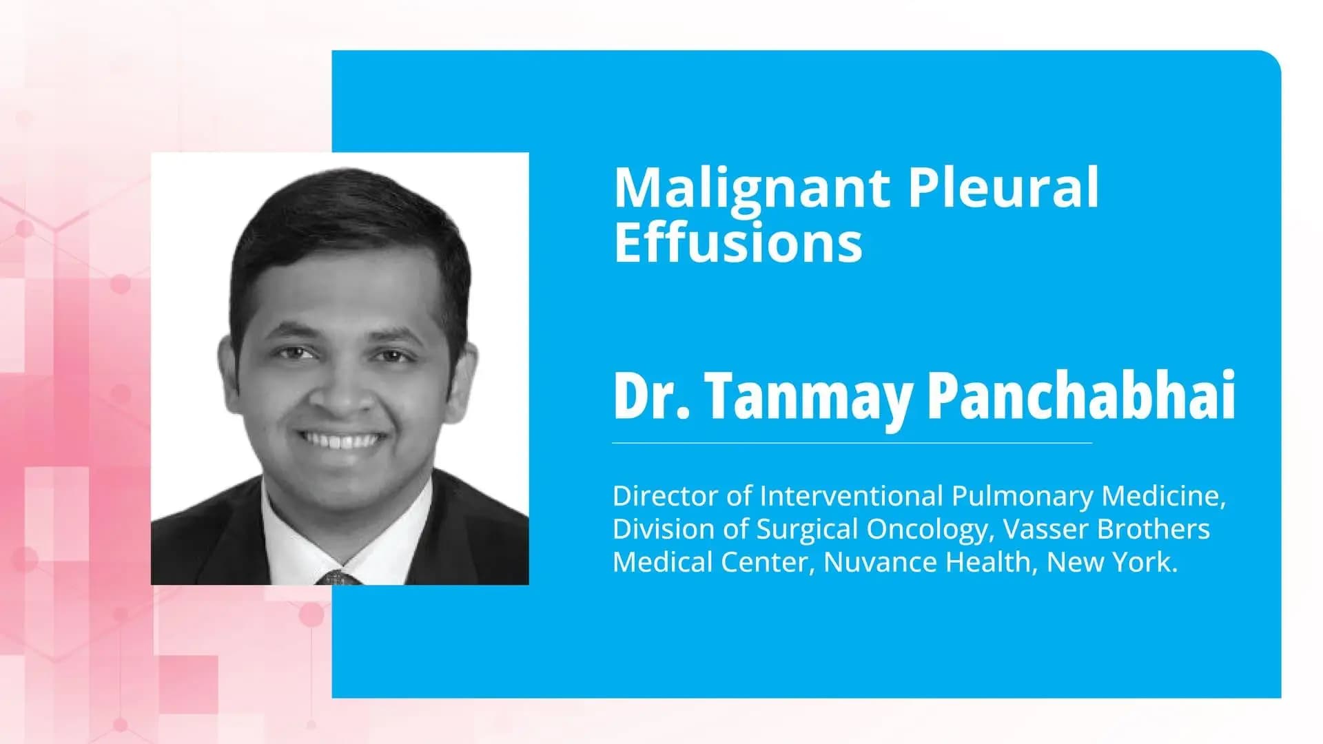 Malignant Pleural Effusions