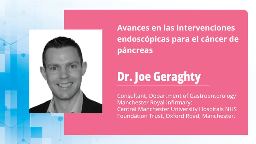 Avances en las intervenciones endoscópicas para el cáncer de páncreas