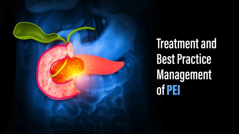 Treatment and Best Practice Management of PEI