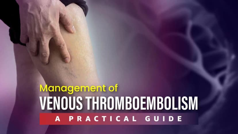 Comparison of Three Trials and Their Outcomes with Conclusions