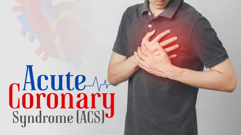 Management Of Acute Coronary Syndrome in India – Is it Different?