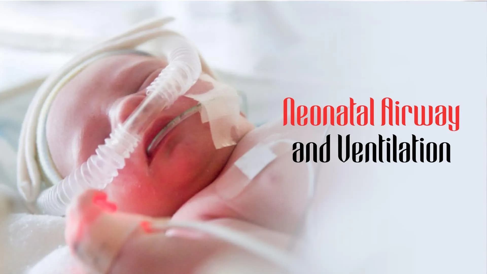 Neonatal Airway and Ventilation