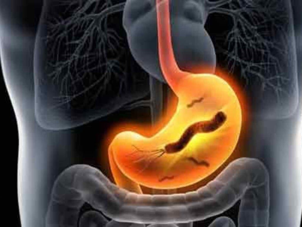 H. pylori infection & NAFLD: what is the correlation?
