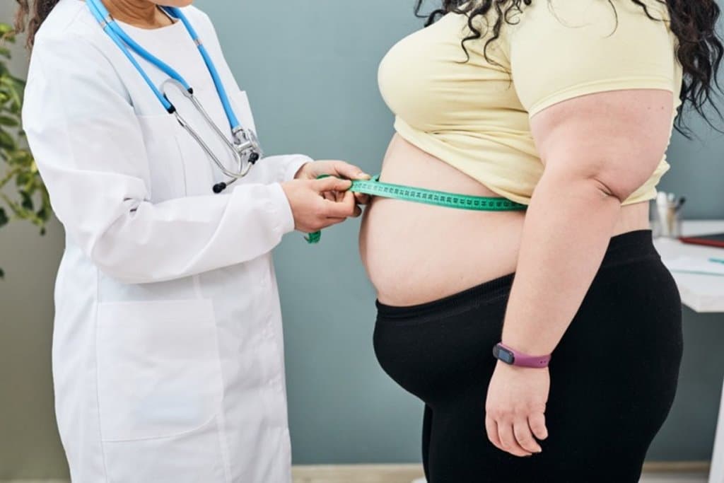 Sleeve gastrectomy impacts nutritional status of patients’ post-surgery