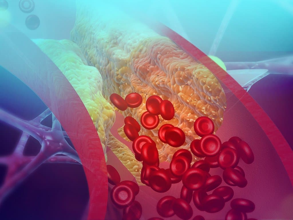 CMR by itself is insufficient to detect CAD in reduced LVEF patients