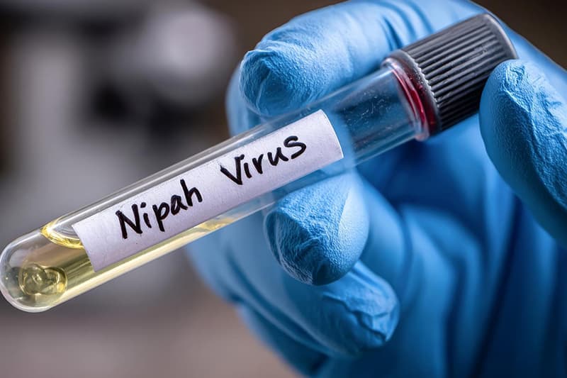 Nipah Virus Recovery: Understanding Fatal Complications