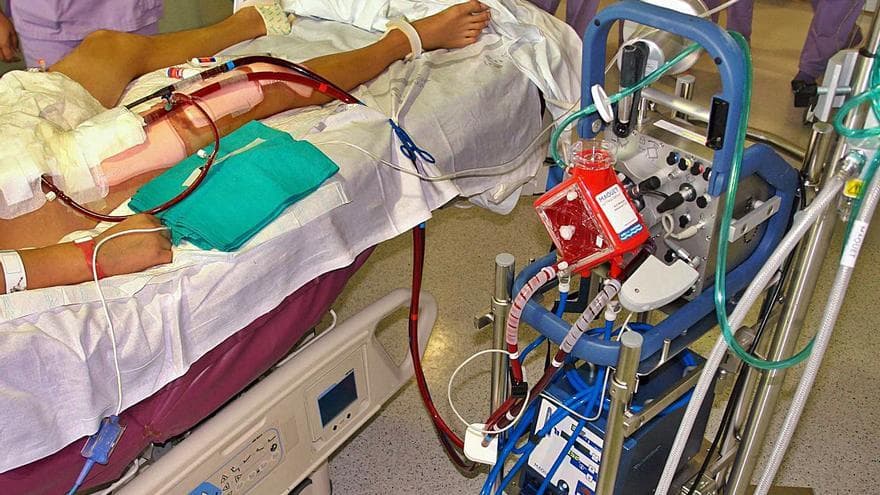 Low-flow ECMO ventilation may help liberation—but the evidence is still early
