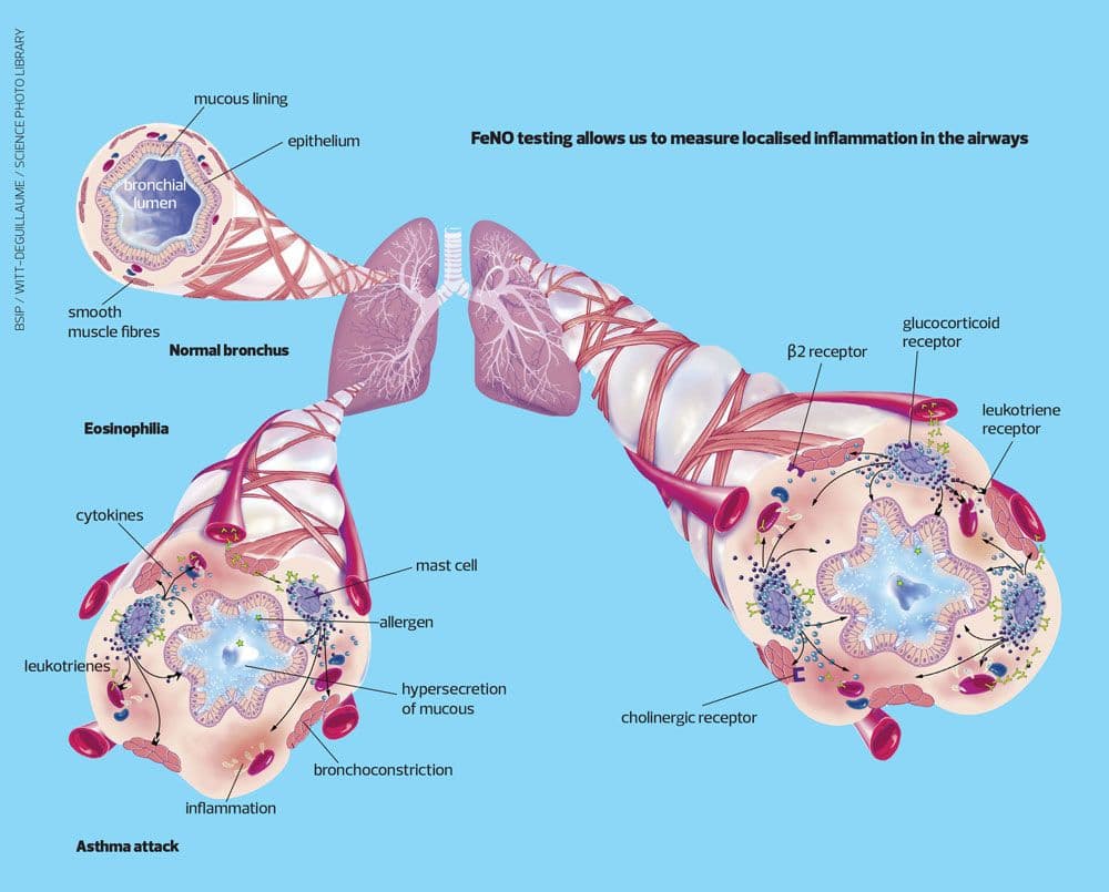 Inhaler Education Works—but Technique Decays Without Reinforcement