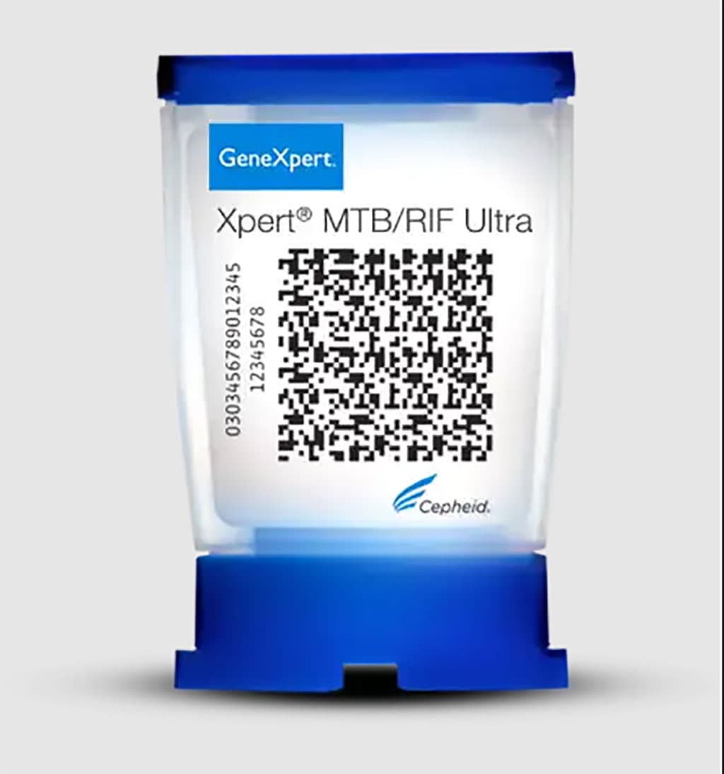 Xpert Ultra Is More Sensitive Than Xpert for Detecting TB in Paucibacillary Disease
